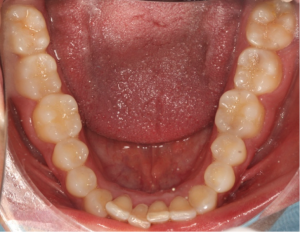 casos reales clínica dental SyS
