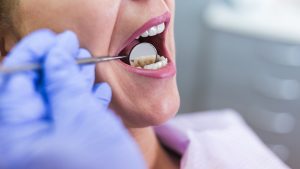 revisión dental